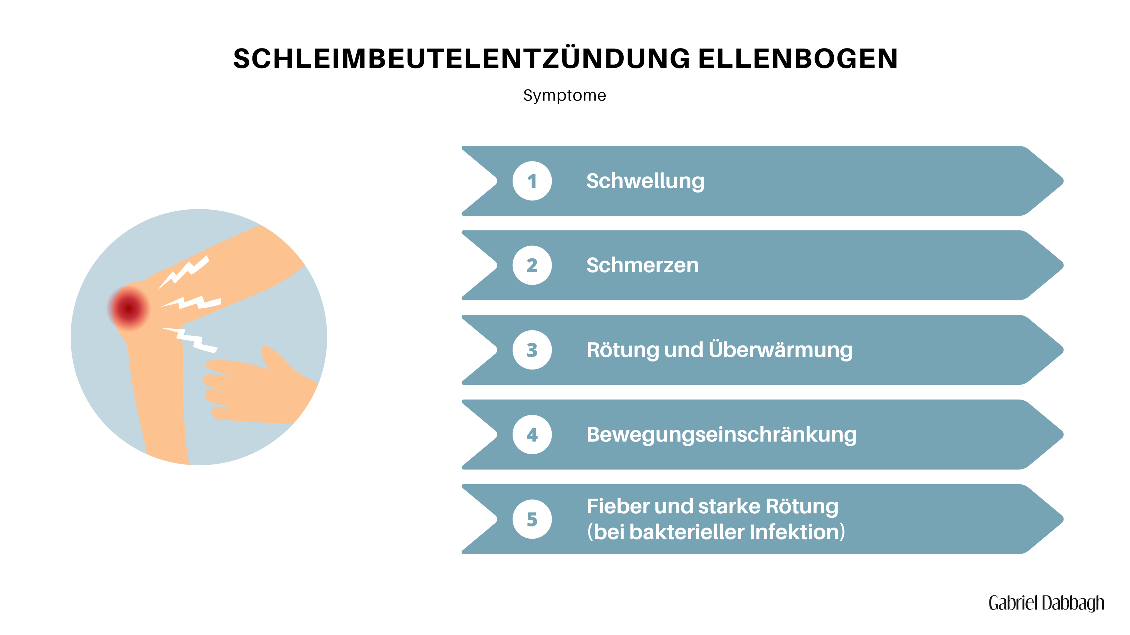 Schleimbeutelentzündung Ellenbogen » Ursache bis Behandlung